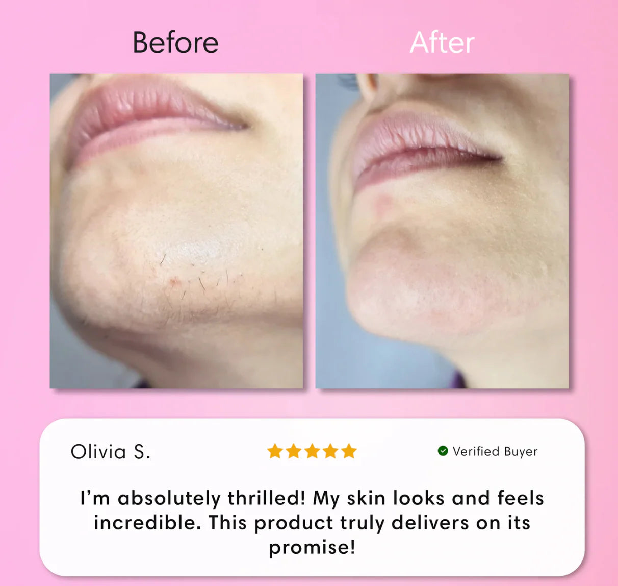 Instant Hair Removal + Free Calming Aloe vera Serum 🎁