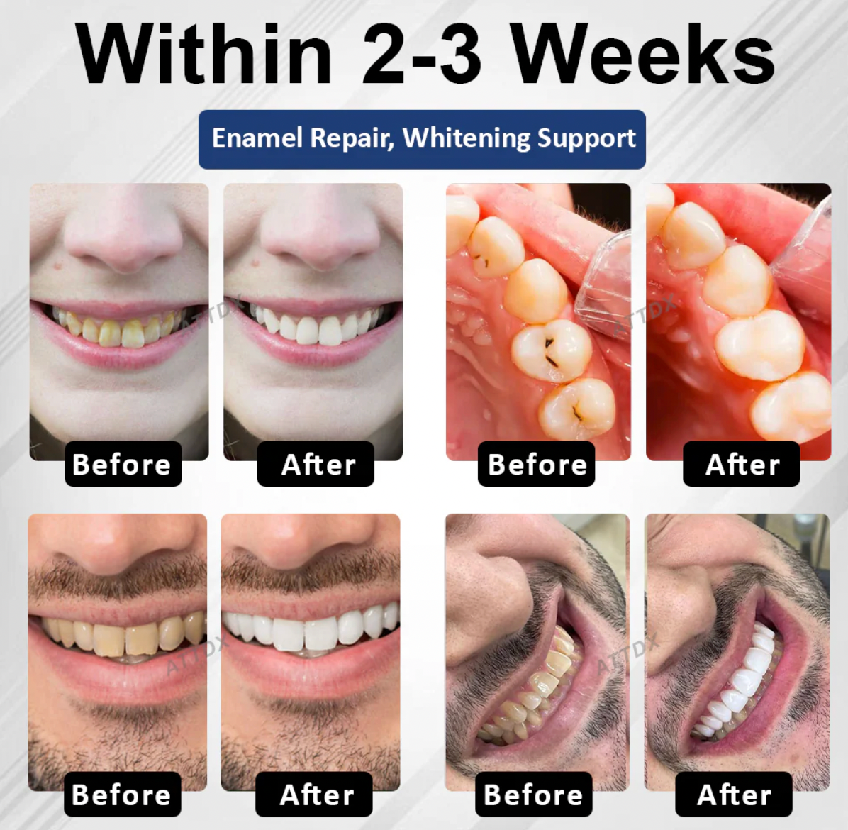 NEW ✨ DentaShield™ Tooth Repair