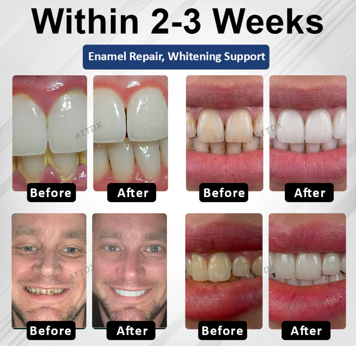 NEW ✨ DentaShield™ Tooth Repair