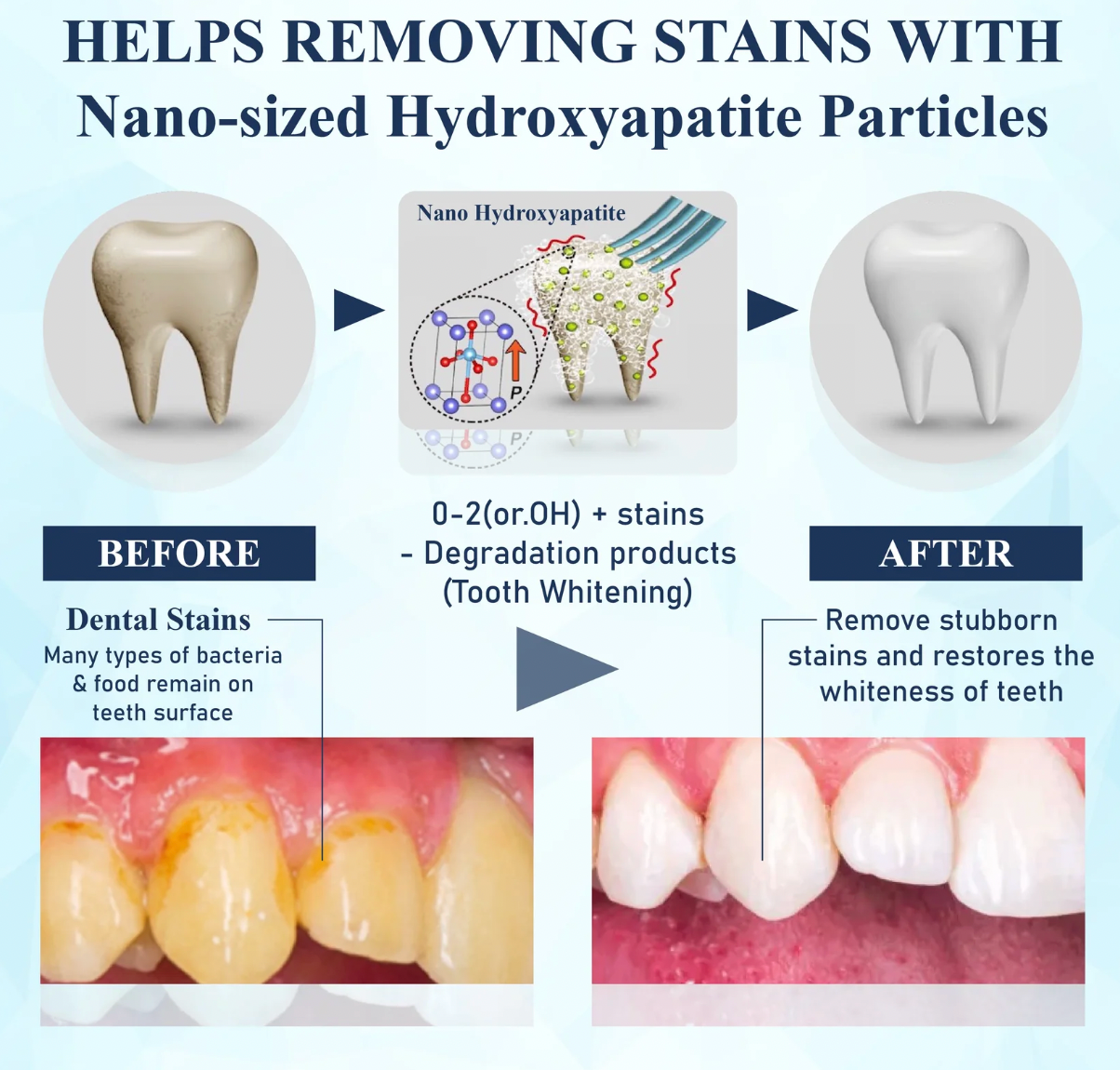 NEW ✨ DentaShield™ Tooth Repair